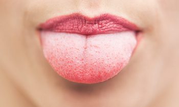 lingua-bianca-e-cattiva-digestione-quando-la-lingua-e-lo-specchio.della-salute-1-biochetasi